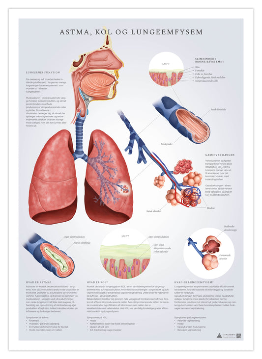 Plakat der forklarer astma, KOL og emfysem
