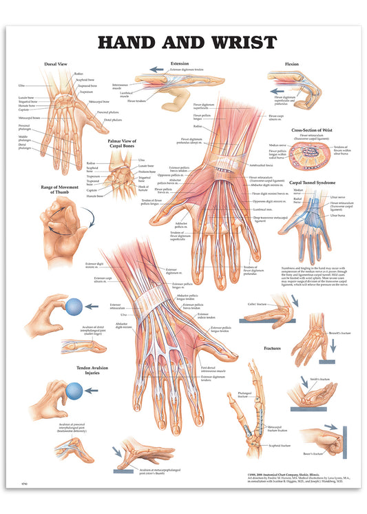 Plakat om hånden og håndleddets anatomi & skader på engelsk I