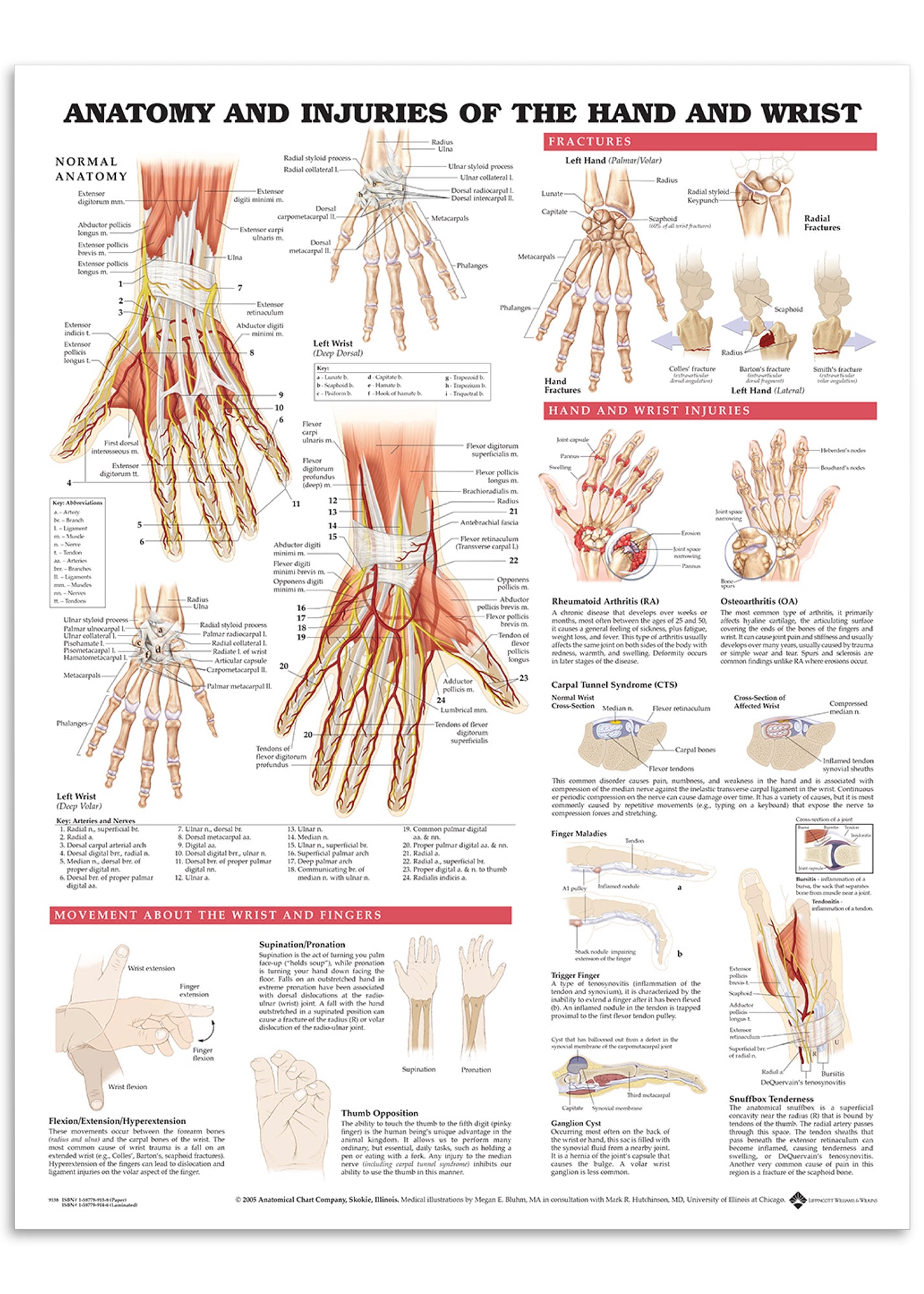 Plakat om hånden og håndleddets anatomi & skader på engelsk