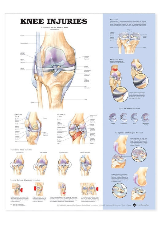 Plakat om knæskader på engelsk