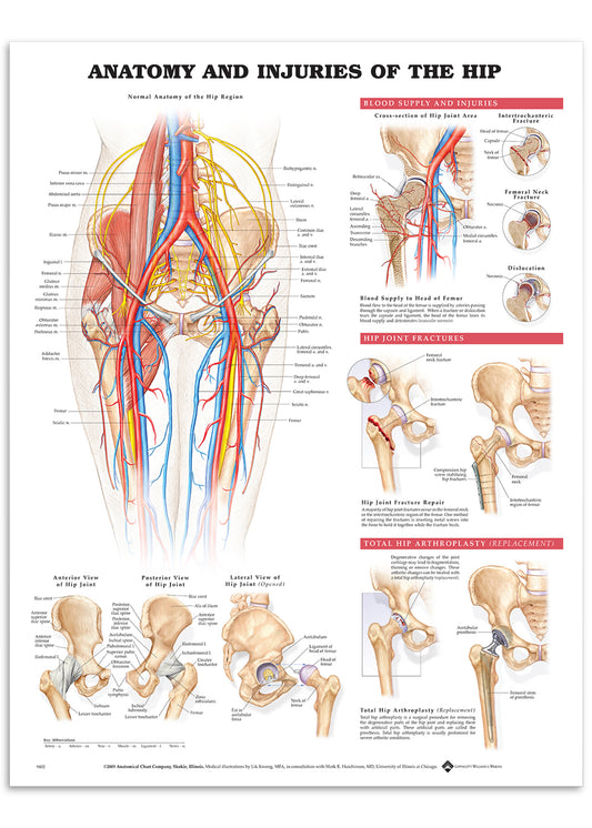 Plakat om hoftens anatomi & skader på engelsk