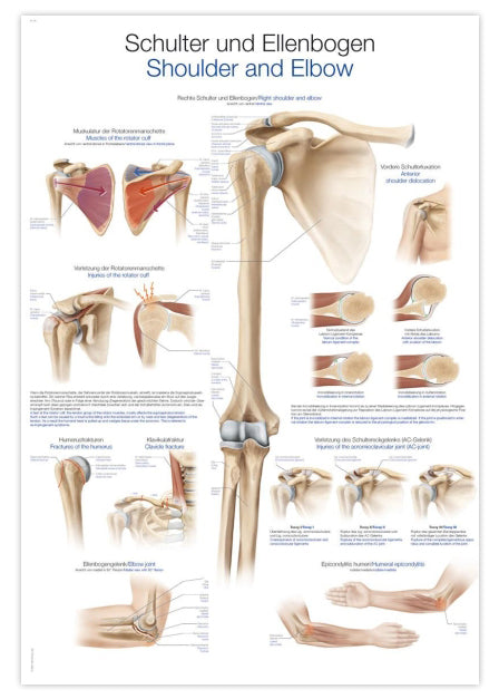 Laminated poster about shoulder and elbow anatomy &amp; injuries in German and English