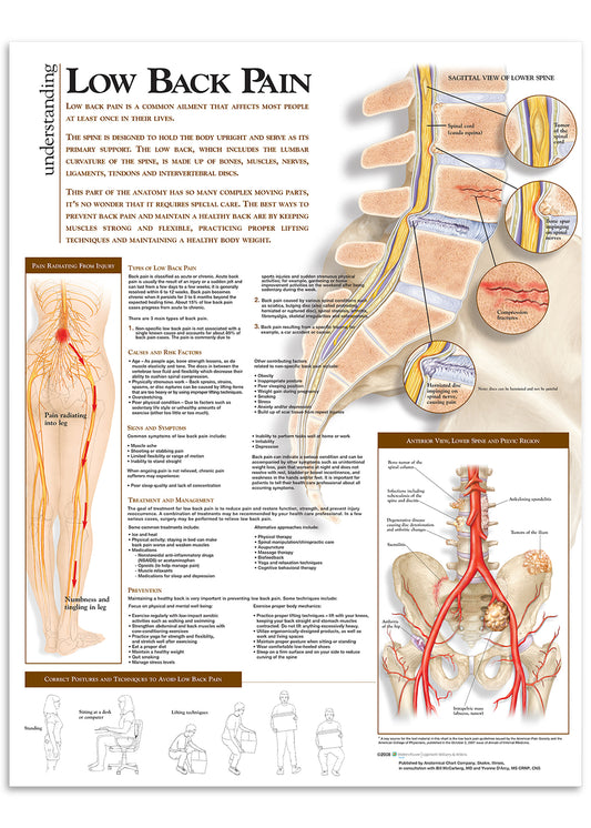 Poster about lower back pain in English