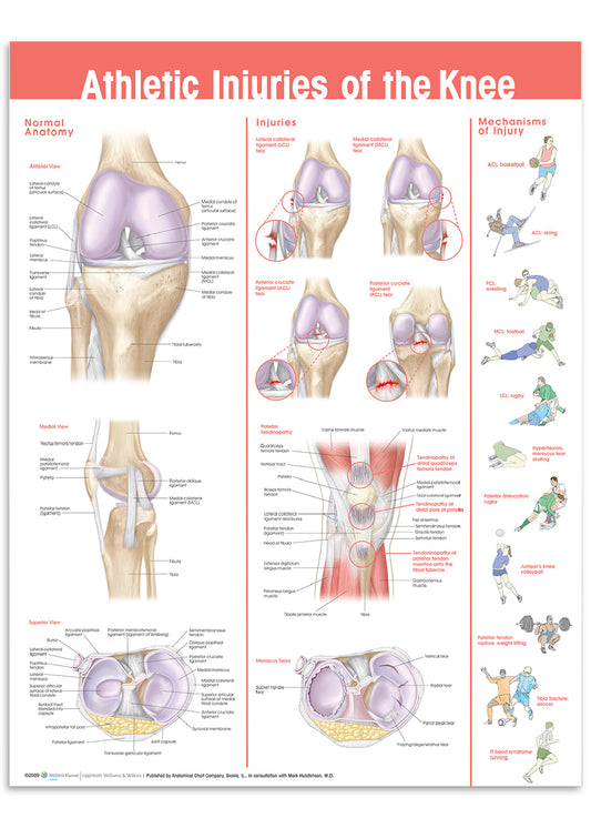 Affisch om knäskador på grund av sport på engelska