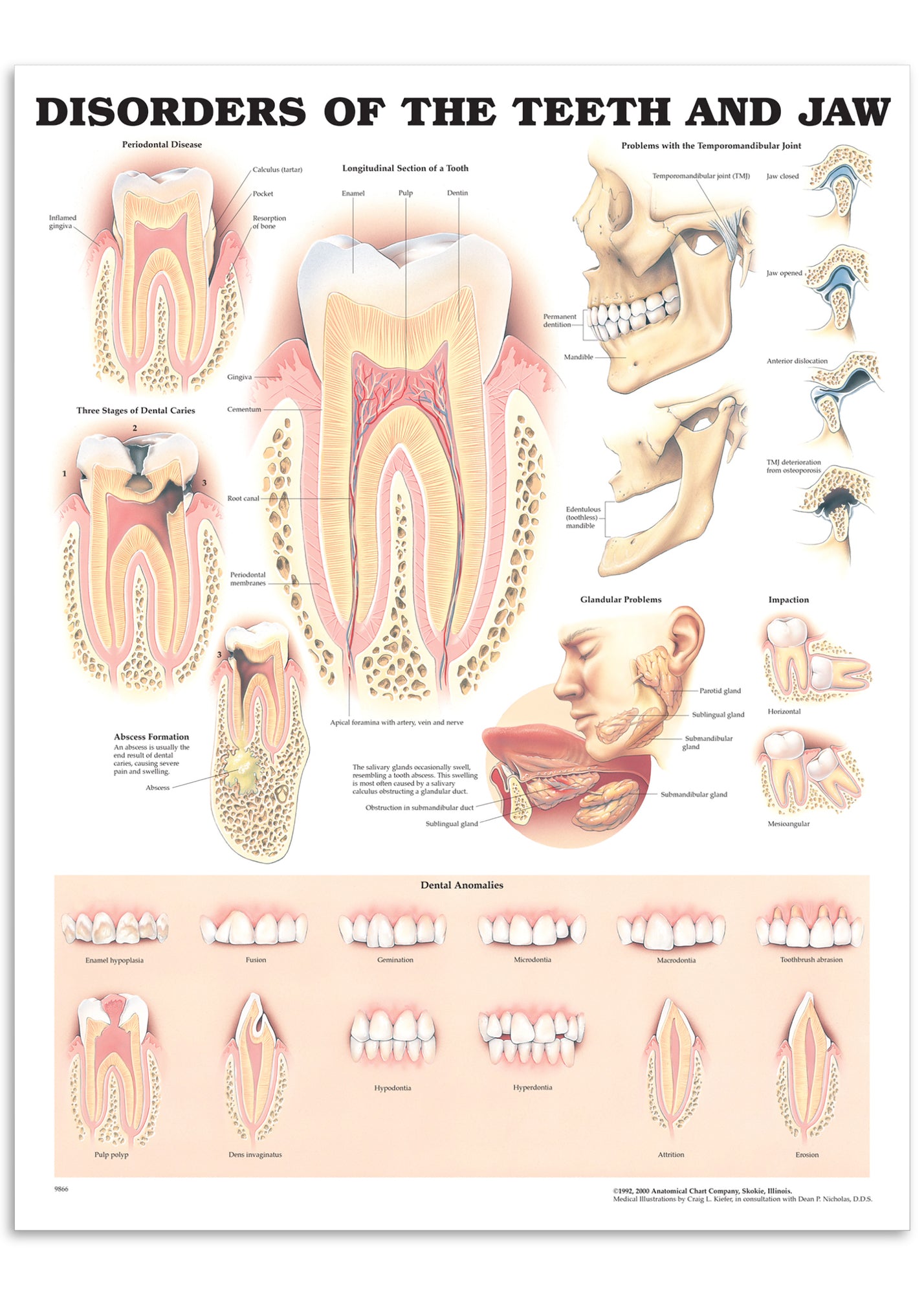 Plakat om lidelser i tænder & kæbe på engelsk