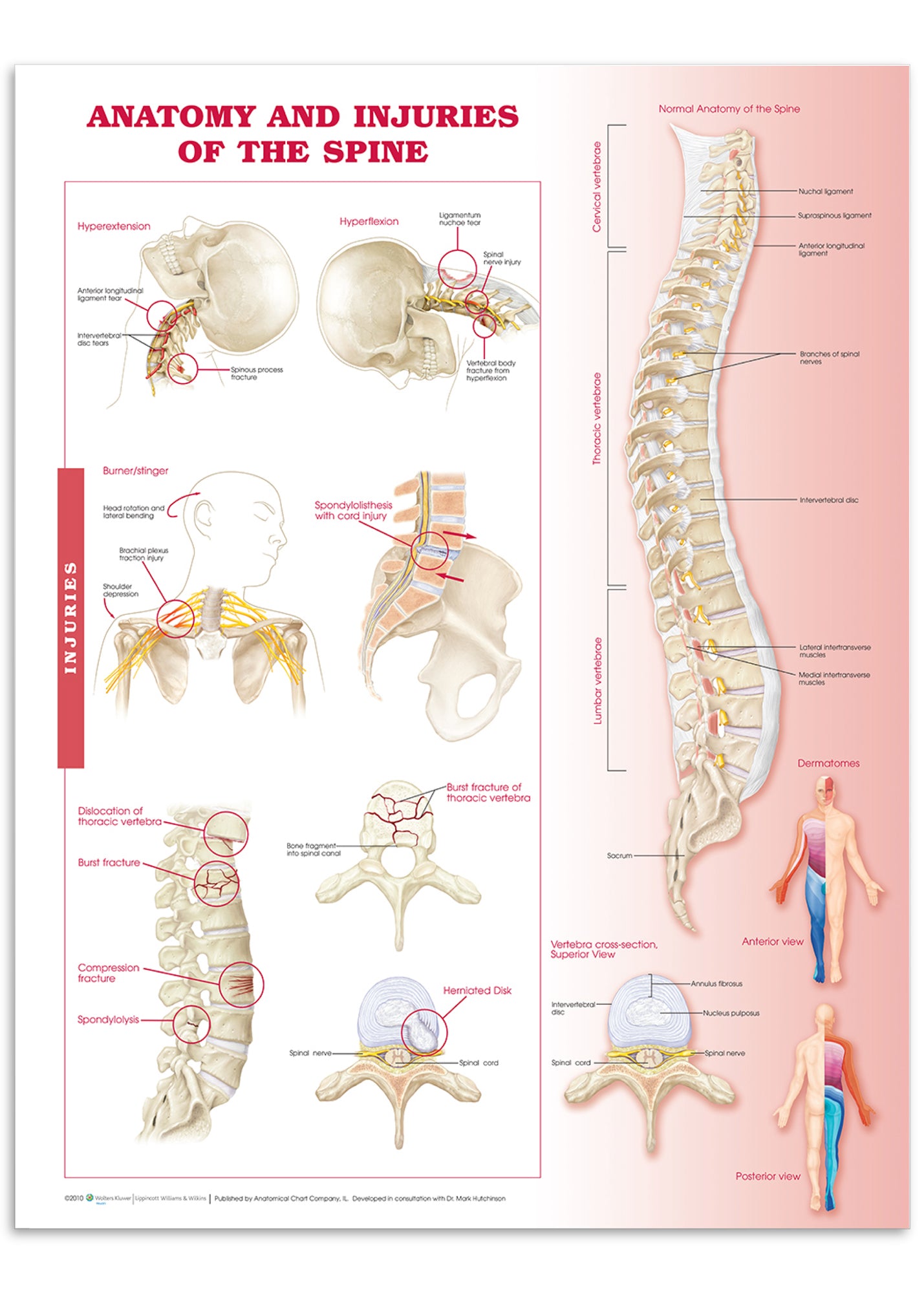 Poster about spine anatomy and back disorders in English