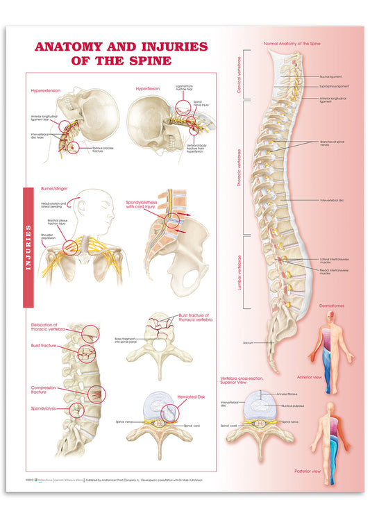 Plakat om rygsøjlens anatomi og lidelser i ryggen på engelsk