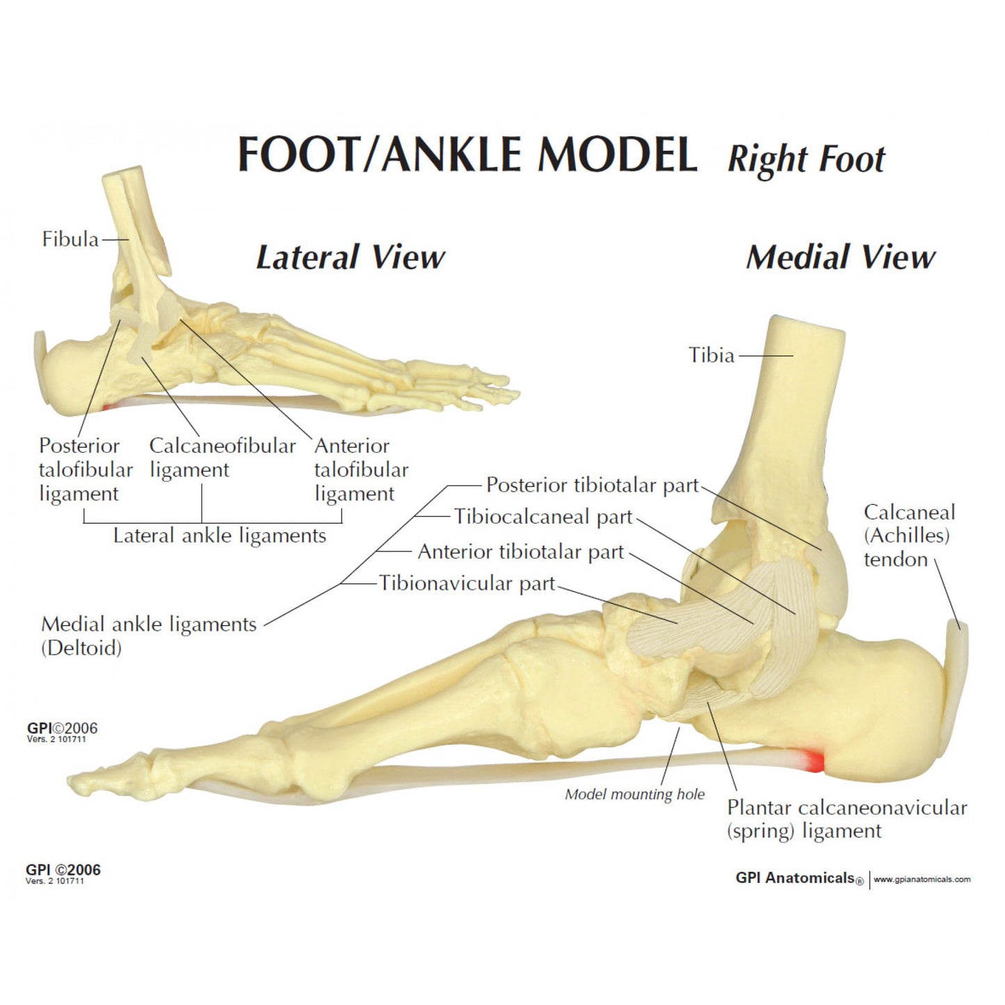 Heel spur (plantar fasciitis) foot model
