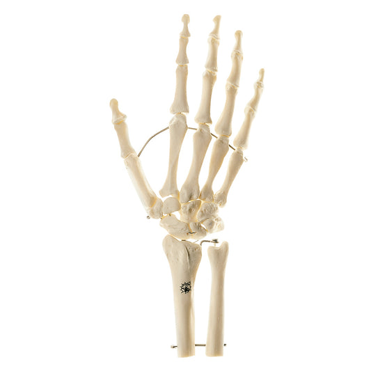 SOMSO Skeletmodel af højre hånd med del af underarmsknoglerne