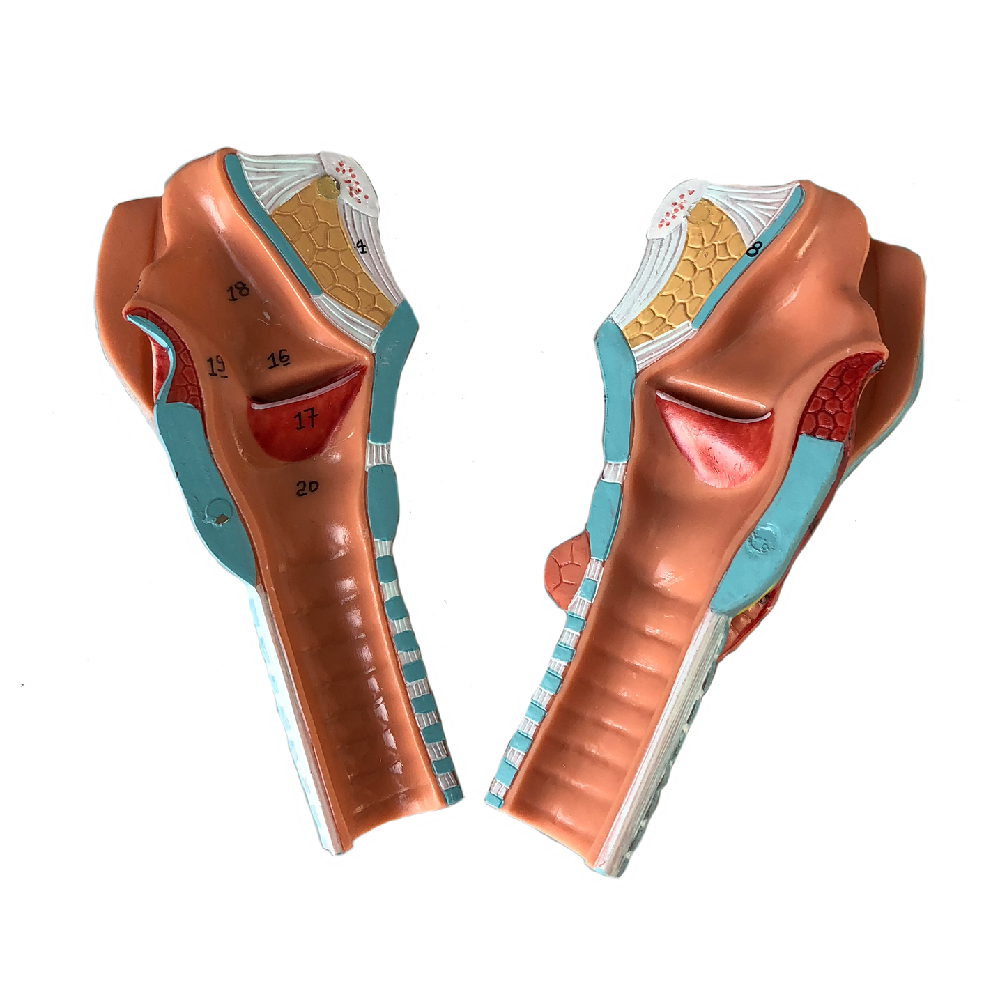 Larynx model with vocal folds and several other tissues. Can be separated into 5 parts