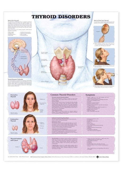 Laminated poster about thyroid diseases in English