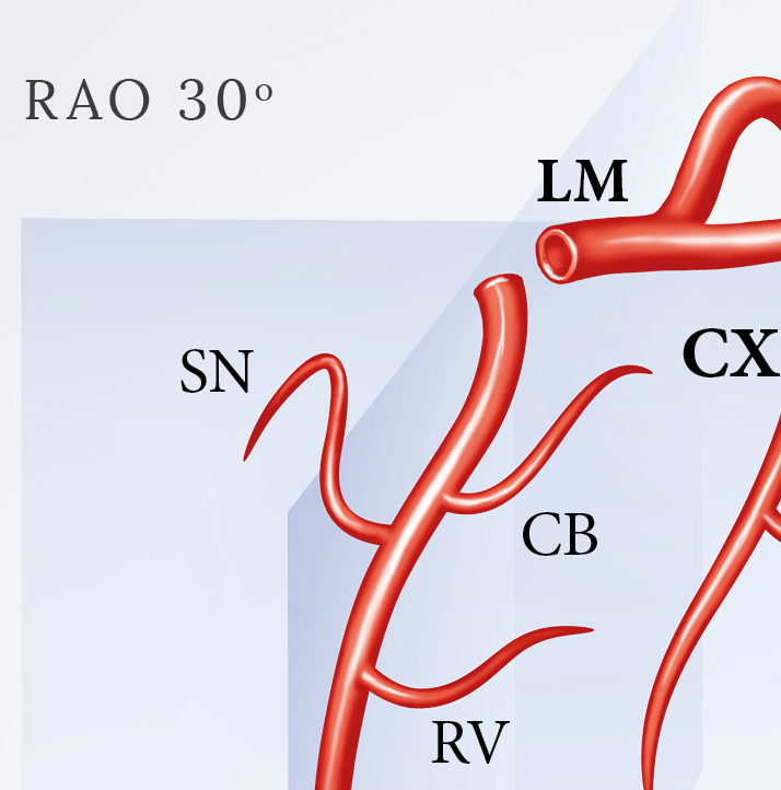 Poster about the coronary arteries of the heart seen in radiographic projections